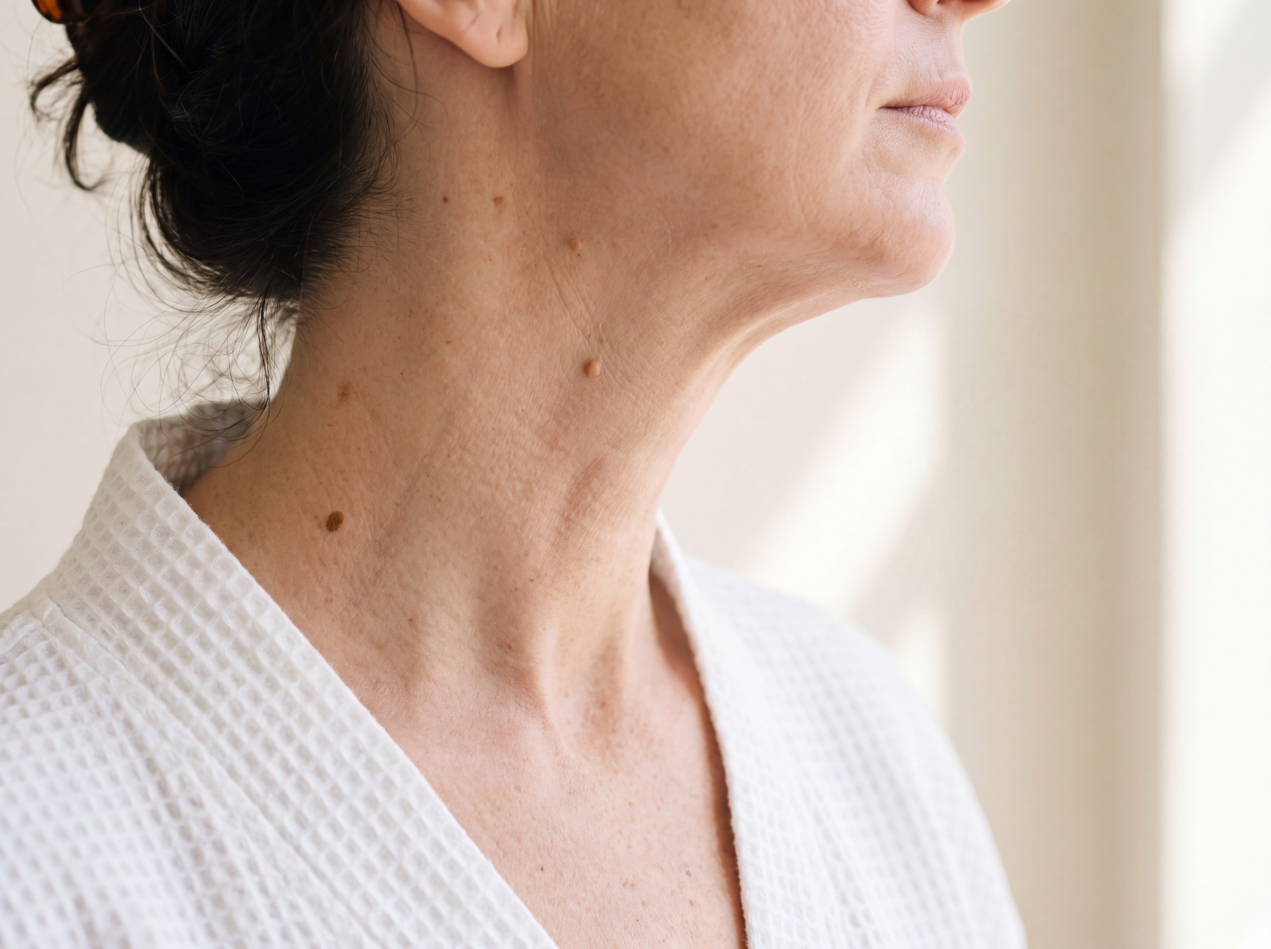 Skin tags and lesions