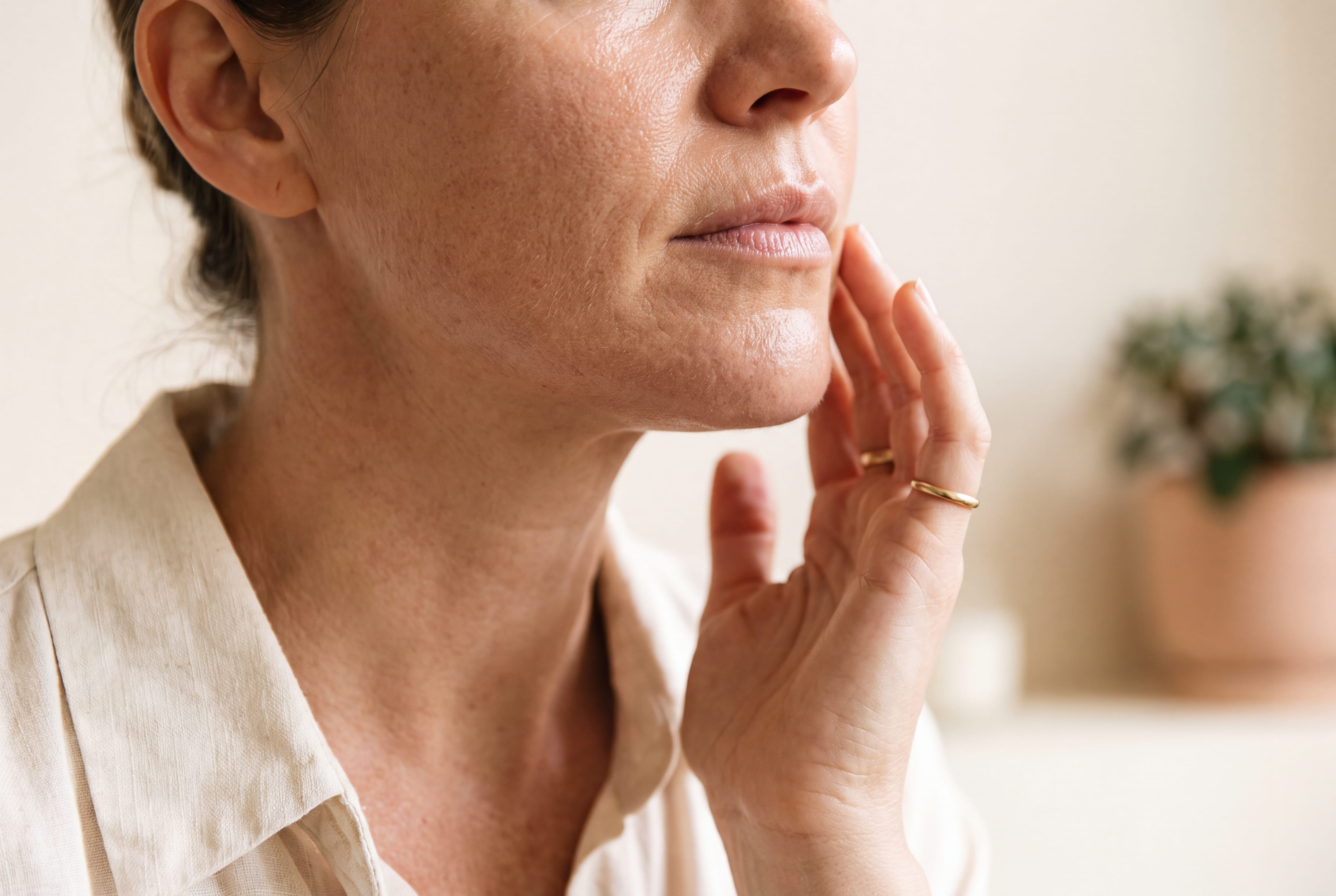 Profhilo or polynucleotides: which skin booster is right for you?